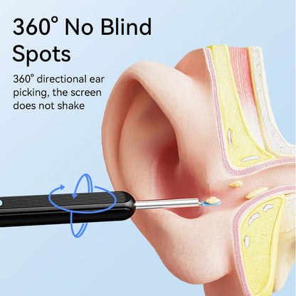 Ear Wax Cleaner with Camera - Safe LED Otoscope & Removal Tool